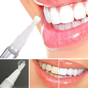 Smile Magic Teeth Whitening - Magic Pen